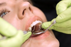 Zahnerhaltung - Zahnärzte Schwarzer - Sann in Castrop-Rauxel Ickern